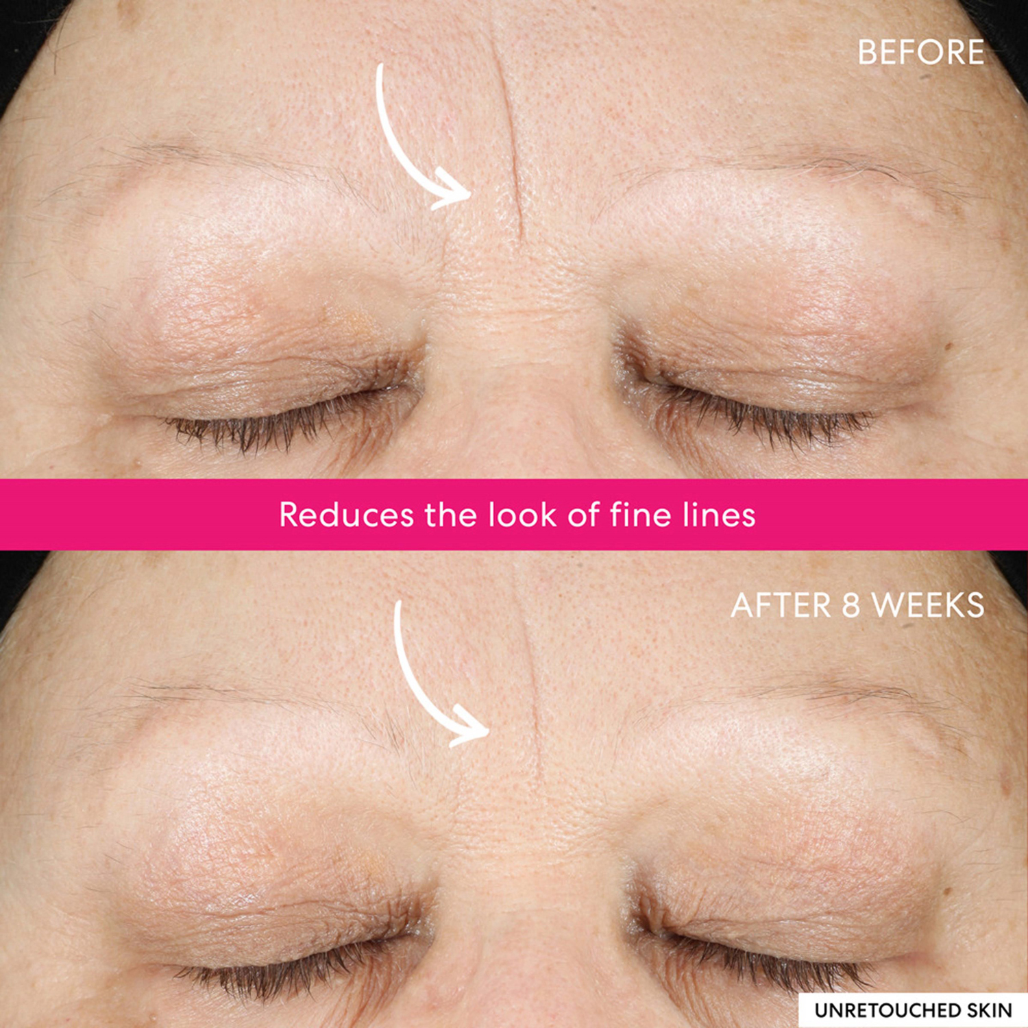 Ageless Phyto-AHA Radiance Facial