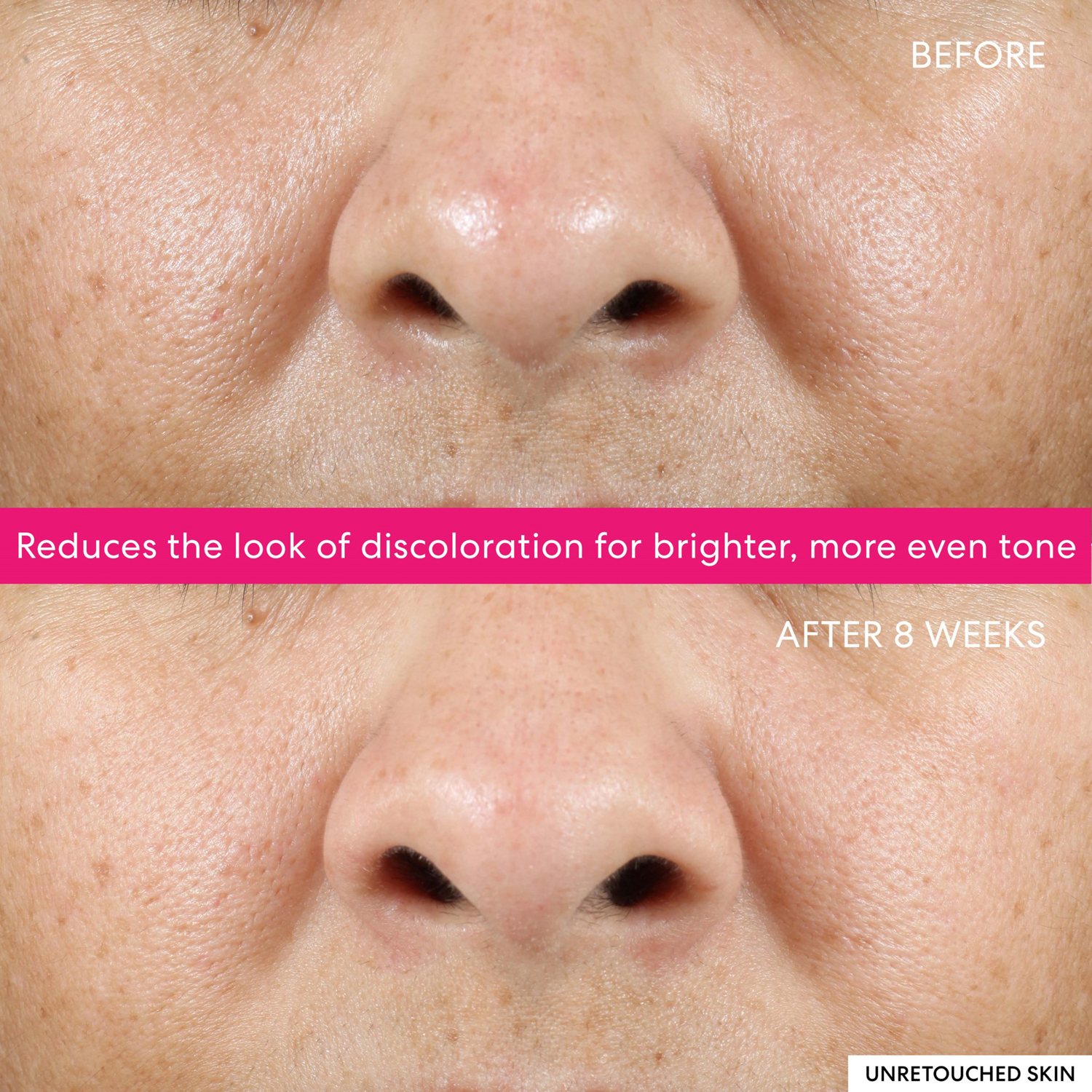 Ageless Phyto-AHA Radiance Facial