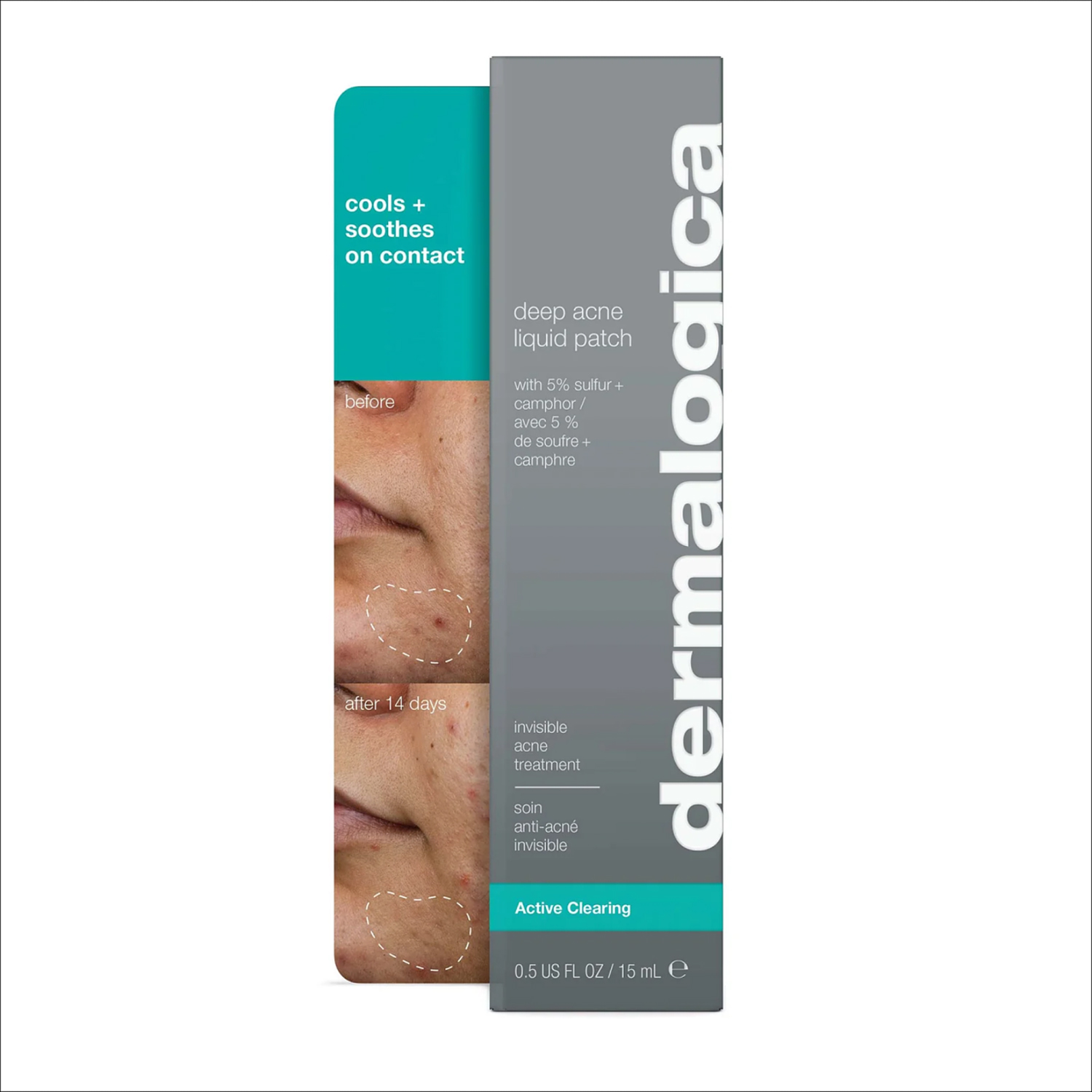 Deep Acne Liquid Patch